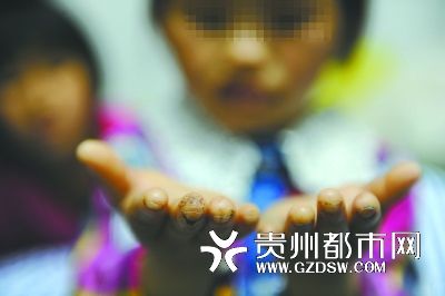 指尖被針扎得傷痕累累。