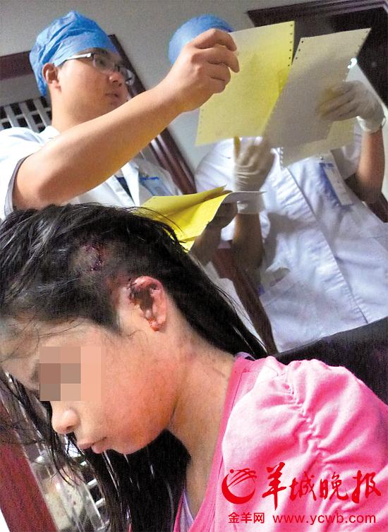 受傷的11歲女孩頭發(fā)被卷入扶梯，耳朵被嚴(yán)重拉傷，需手術(shù)。