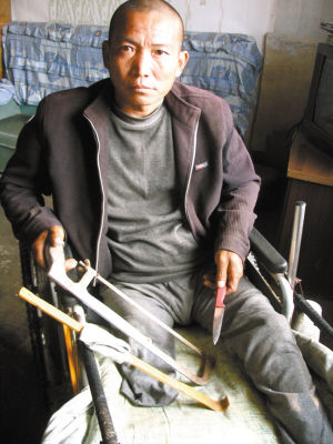 鄭艷良就是用這幾樣簡陋工具，給自己做了右腿截肢手術(shù)。