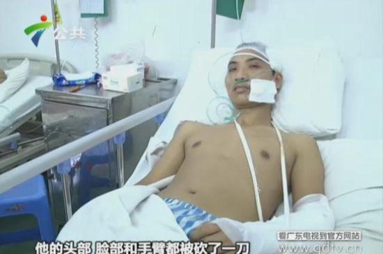 另一名傷者頭部、臉部和手臂都被砍了一刀。(視頻截圖)