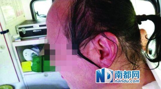 涉事教師遭熱水潑臉后的照片。