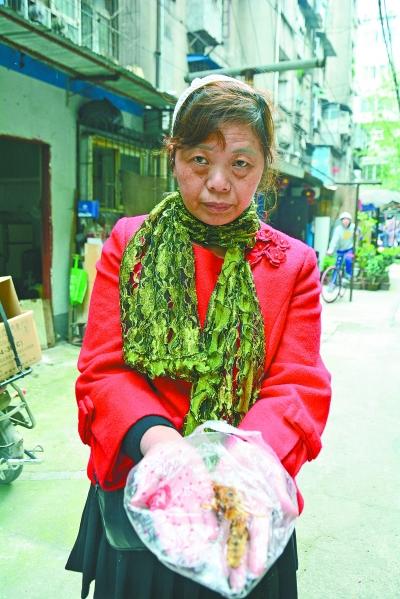 頭部受傷的黃女士展示兩根大魚刺。