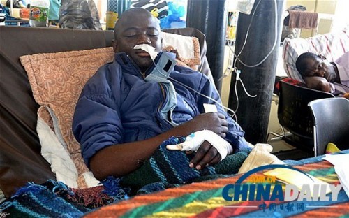 雖然已經(jīng)在醫(yī)院接受了近一個(gè)月的恢復(fù)治療，卡托卡的身體仍然非常虛弱。