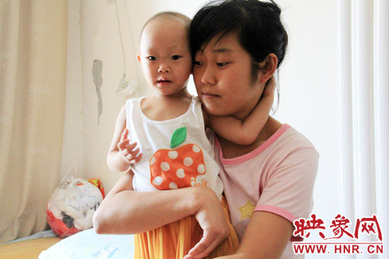 孩子和媽媽在一起，她的右眼已經(jīng)失明。