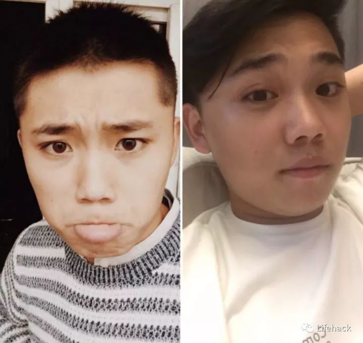 長胖20斤，臉型怎么變？這些例子看完扎心了！