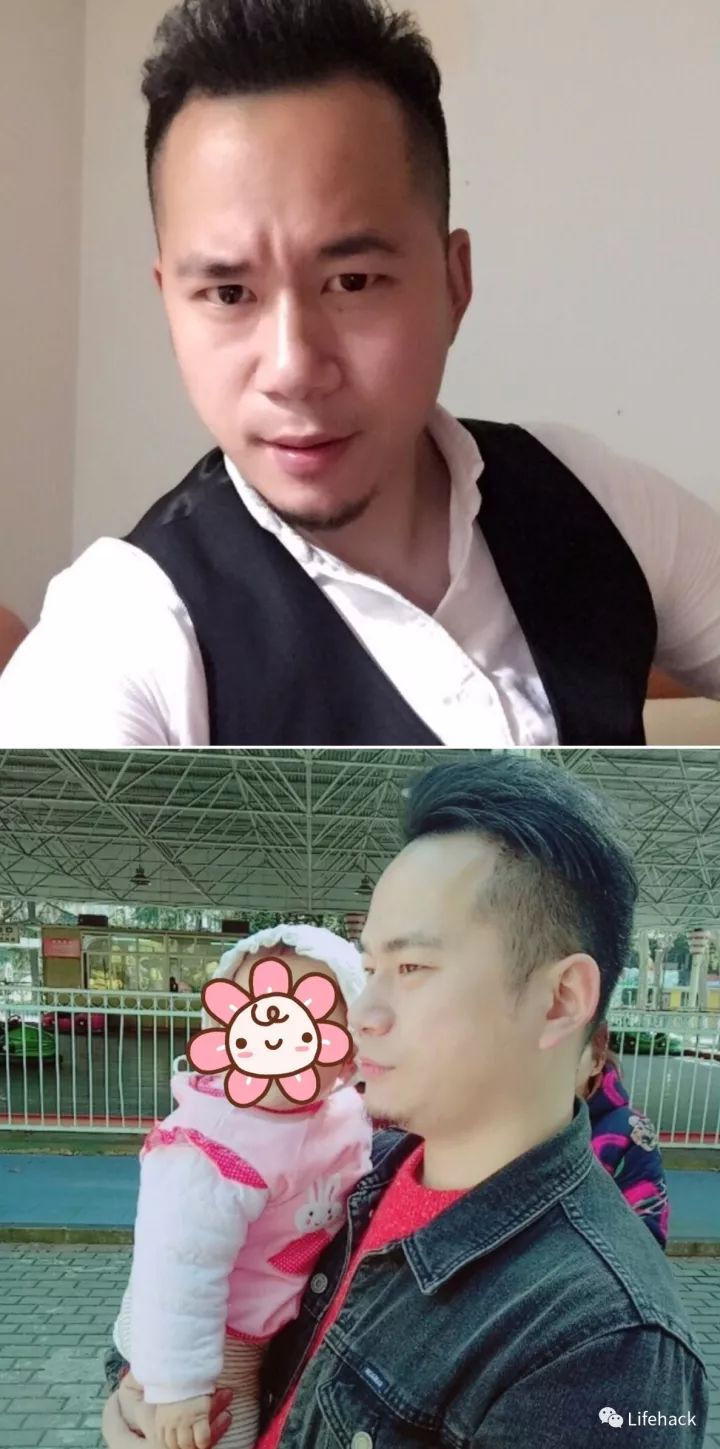 長胖20斤，臉型怎么變？這些例子看完扎心了！