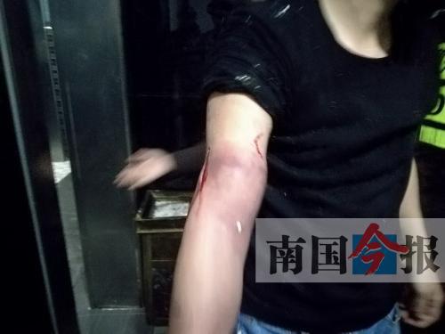 覃先生手臂被卡的部位受傷流血，所幸傷勢無大礙。 通訊員 王建民 攝