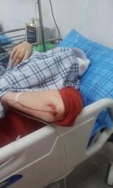 砸窗當(dāng)事人胡女士在醫(yī)院接受治療。