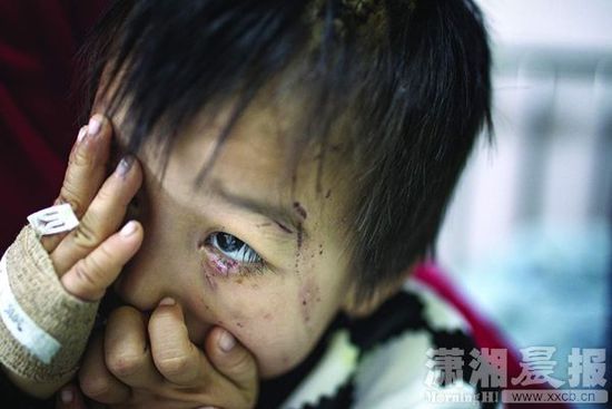 1月13日，湖南省兒童醫(yī)院，4歲的源源用手蒙住了眼睛。
