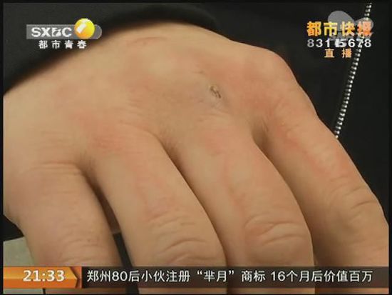 說到這足療拔罐，估計大伙都不陌生，但是想起4號晚上的拔罐的經(jīng)歷，呂先生現(xiàn)在想起來，還心有余悸。