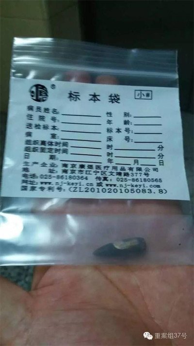 經(jīng)警方鑒定，秦女士體內(nèi)取出的子彈系56式步槍射出 。 受訪者供圖